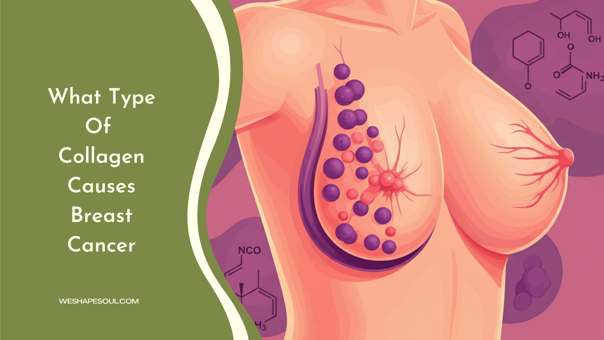 what type of collagen causes breast cancer-weshapesoul